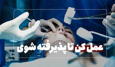 خبرگزاری فارس - فیلم| جراحی زیبایی یا چشم و هم‌چشمی؟