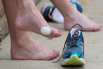 راهکارهای ساده برای جلوگیری از تاول زدن پا در کفش