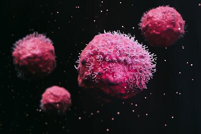 عواملی که خطر ابتلا به سرطان پروستات را کاهش می‌دهند