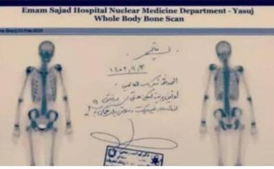 مرکز پزشکی هسته ای استان با تجهیزات مدرن فعال است