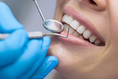آمار بالای دندان‌های خراب ایرانی‌ها/ کشیدن دندان؛ تنها گزینه مردم | رویداد24