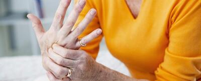 احتمال آرتروز انگشتان دست در چه کسانی بیشتر است؟
