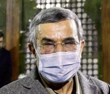 علت کبودی های سوال برانگیز چهره احمدی نژاد مشخص شد؟ + عکس