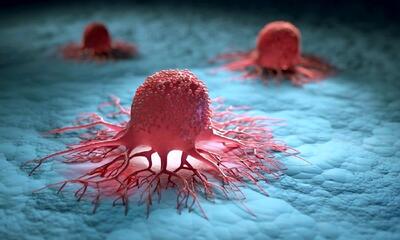 کشف روش جدید برای تشخیص زودهنگام یک سرطان خطرناک