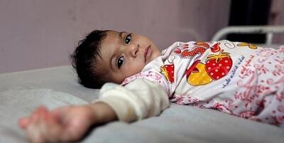 خبرگزاری فارس - شایع‌ترین دلیل دردهای شکمی اطفال