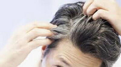 روش‌های ساده خانگی برای از بین بردن چربی موی سر