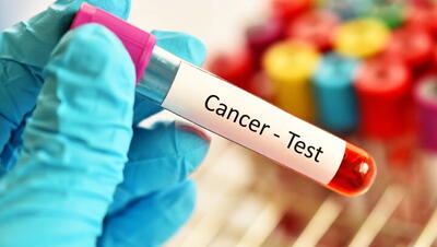 غربالگری سرطان برای شناسایی و درمان زودهنگام بیماری ضروری است