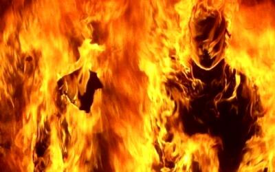 میله آهنی در پهلوی مرد سوخته شده در آتش / مرد نسیم‌شهری زنده زنده سوزانده شده؟