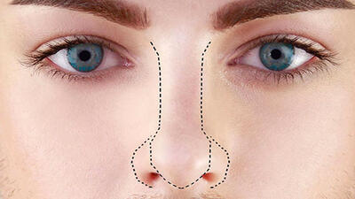 فرم دهی بینی بدون جراحی با روش های تزریق ژل، نخ، لیزر و…