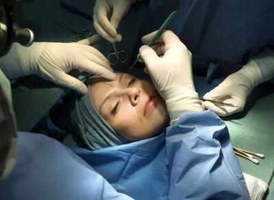 چهره اصیل ایرانی، زیر تیغ جراحی های زیبایی