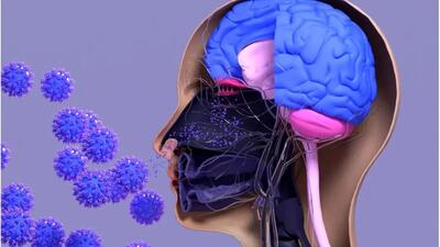 عفونت های ویروسی بر خطر آلزایمر تأثیر گذارند
