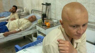 سرطان پروستات دومین سرطان شایع مردان ایرانی/ سیگار و قلیان از عوامل ابتلا به ۲ سرطان