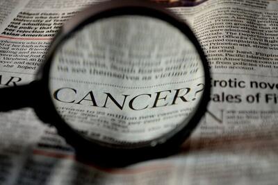 سرطان پروستات دومین سرطان شایع مردان ایرانی/ سیگار و قلیان از عوامل ابتلا به ۲ سرطان