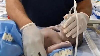تلاش‌های یک پزشک برای احیای نوزاد تازه متولد شده