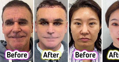(تصاویر) شهرت باورنکردنی یک جراح پلاستیک به دلیل تغییرات ترسناکی که با لیفت صورت ایجاد می کند