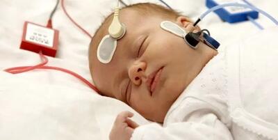 کم شنوایی جزء شایع ترین اختلالات بدو تولد است