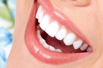 راهکاری آسان برای جلوگیری از پوسیدگی دندان