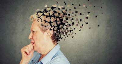 فرضیه‌ای جدید درباره علت آلزایمر