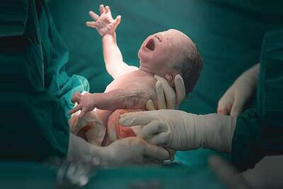 تولد ۱۰ هزار و ۳۲۸ نوزاد در بیمارستان‌های تابعه دانشگاه علوم پزشکی خراسان شمالی