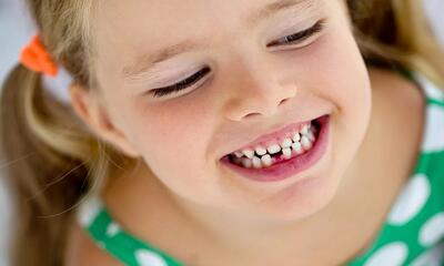 چگونه از دندان‌های کودک مراقبت کنیم؟