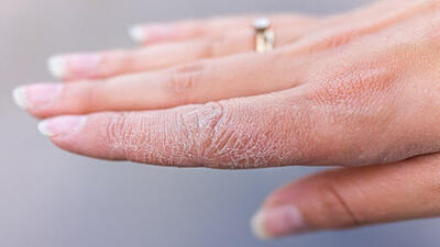 توصیه‌هایی برای مراقبت از پوست در روزهای «خانه تکانی»