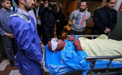 سه مورد تخلیه چشم، حاصل حوادث چهارشنبه‌سوری در استان مرکزی