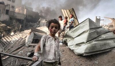 فیلم و عکس | شرایط فاجعه‌بار کودکان غزه قابل وصف نیست