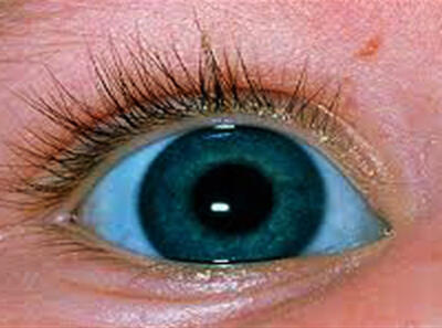 معمای رنگ آبی سفیدی چشم؟