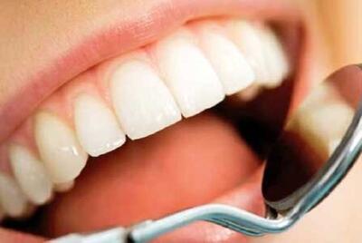 هر ایرانی ۶ دندان پوسیده دارد | اقتصاد24