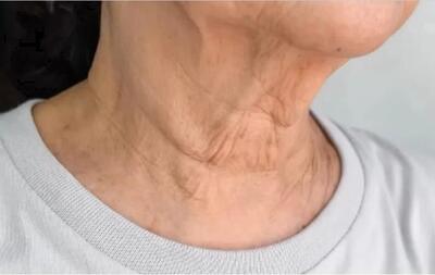 چطور از پیری پوست در ناحیه گردن جلوگیری کنیم؟