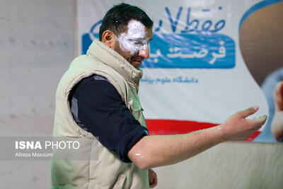 تصاویر | عکس‌های تلخ از مصدومان حادثه چهارشنبه‌سوری