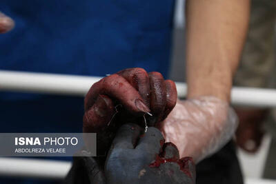 انفجار نارنجک باقی‌مانده از چهارشنبه‌سوری در دستان یک پاکبان
