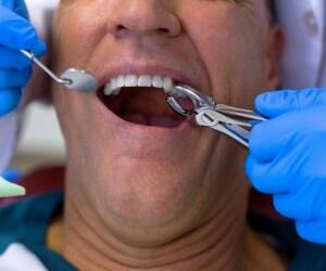 اثرات مخرب دیابت روی دهان و دندان