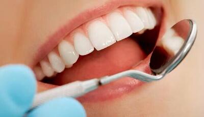 ارائه یک میلیون مراقب سلامت دهان و دندان در خانه‌های بهداشت