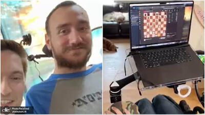 دستاورد مهم: بیمار معلول  نورالینک  ازطریق افکارش شطرنج بازی می‌کند + عکس