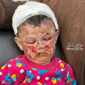 هشدار تصاویر دردناک/ اسرائیل کودکان فلسطینی را می سوزاند