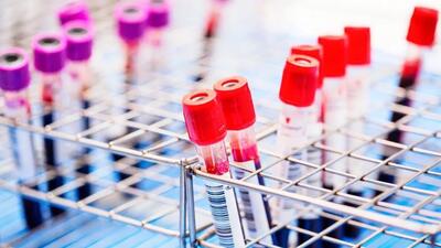 دستاورد جدید: دانشمندان اکنون می‌توانند ویروس HIV را از سلول‌ها جدا کنند