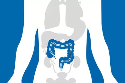 محققان: باکتری عامل پلاک دندان شاید با ابتلا به سرطان روده بزرگ ارتباط داشته باشد