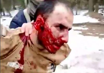 دستگیری سومین عامل حمله تروریستی در مسکو با چهره وحشت زده و خون آلود + فیلم