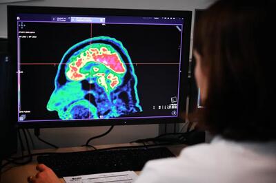 طی یک بررسی؛ استفاده طولانی از موبایل با افزایش ابتلا به سرطان مغز ارتباطی ندارد | خبرگزاری بین المللی شفقنا