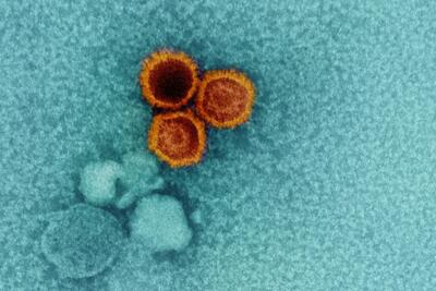 دانشمندان نقطه ضعف یکی از سرسخت‌ترین ویروس‌های جهان را کشف کردند - زومیت