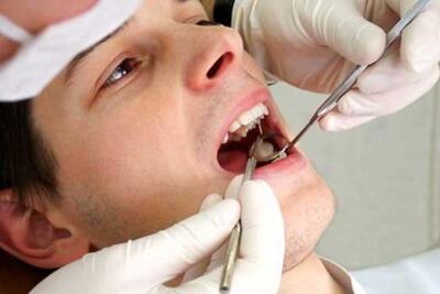 ارتباط آجیل و تنقلات نوروزی با پوسیدگی دندان | بدون این ماده معدنی مسواک نزنید