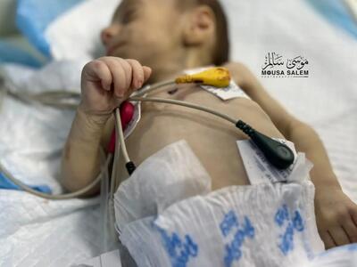 یک کودک دیگر در خطر مرگ از گرسنگی در غزه + عکس