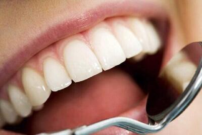 توصیه‌هایی برای بهداشت دهان و دندان در نوروز