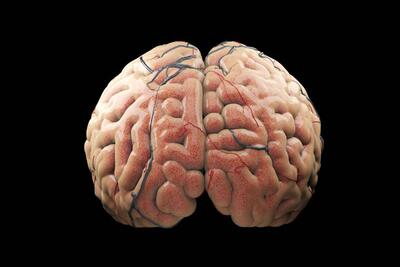 مغز انسان‌ها درحال بزرگ‌تر شدن است - زومیت