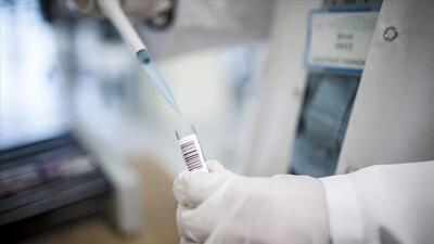 ثبت ابتلای انسانی به ویروس آنفلوآنزای پرندگان در آمریکا