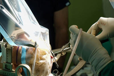 ۷ عمل جراحی عروق طی یک روز در بیمارستان ساری انجام شد