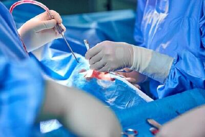 ۷۱۲ عمل جراحی در بیمارستان‌های دامغان صورت گرفت
