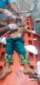 عکس/ مجروح شدن یک کودک بلوچ در حملات تروریستی جیش العدل | اقتصاد24