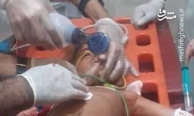 عکس/ کودک بلوچ مجروح شده در حملات تروریستی جیش الظلم